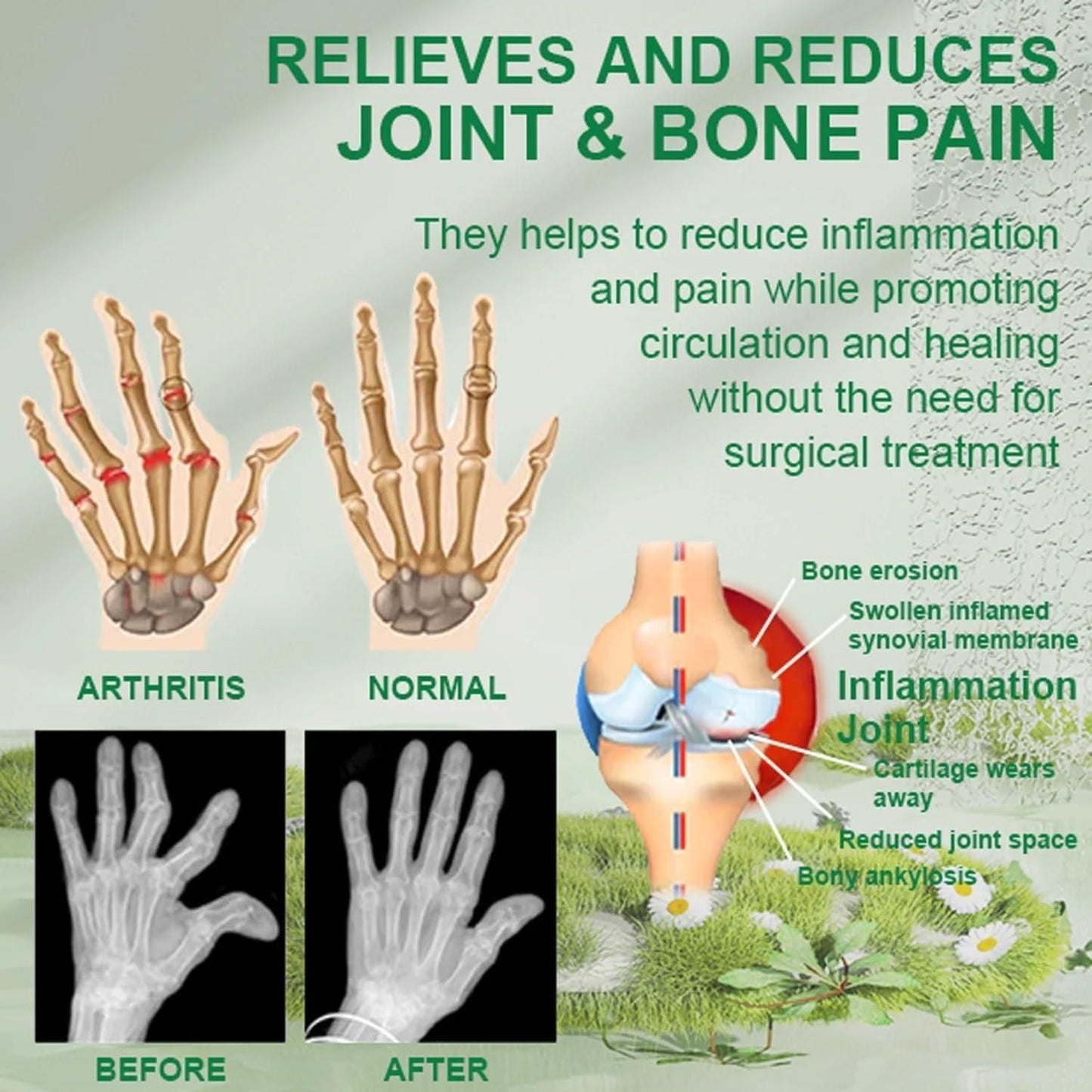 Bee Venom Joint and Bone Therapy Cream 100gm ( BUY 1 GET 1 *FREE* )